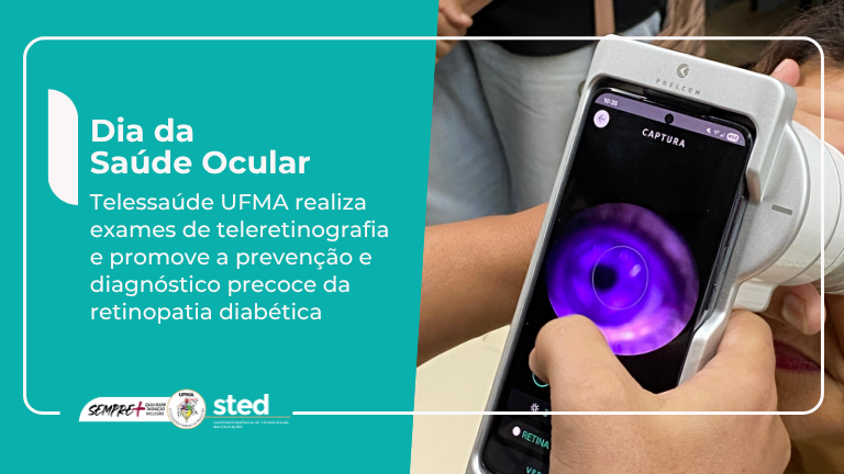 banner 768x432 (9)_saude_ocular
