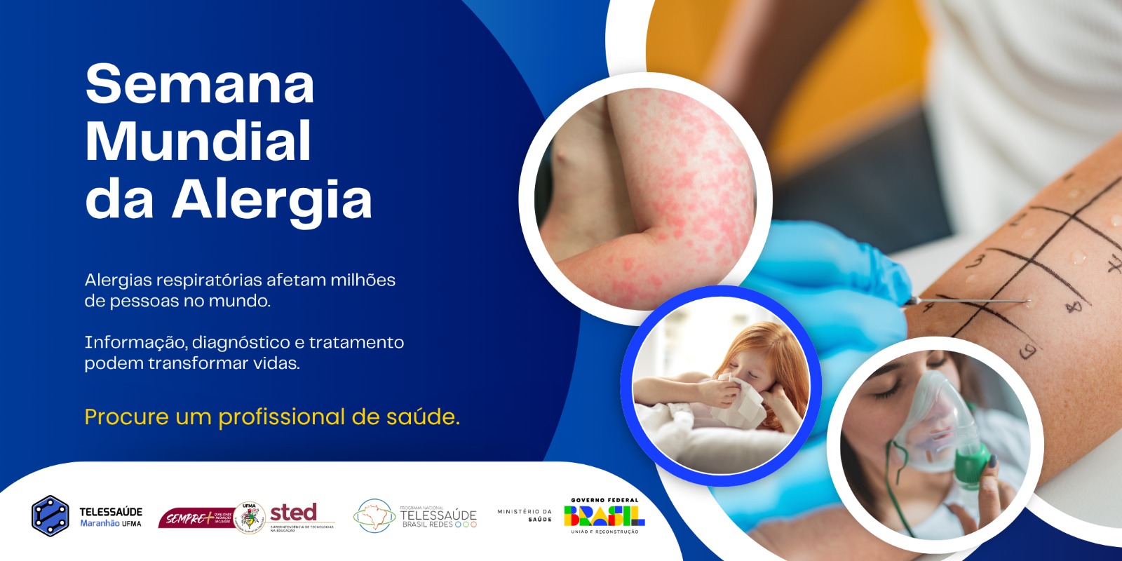 Anafilaxia-informacao-salva-e-o-tema-da-Semana-Mundial-da-Alergia-de-2025.jpg