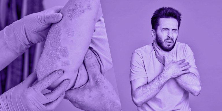 Fotografia Mod 1 Cuidado Reações Anafilática_SAITE AVA.jpg