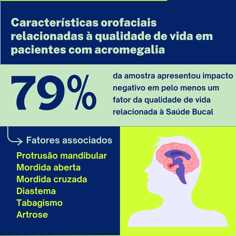 Acromegalia: pesquisadores ligados ao Curso de Odontologia da UFMA desenvolvem pesquisa publicada em revista científica