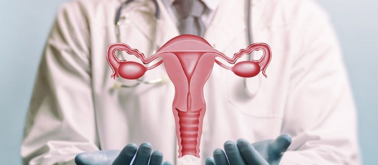 câncer de ovário.jpg