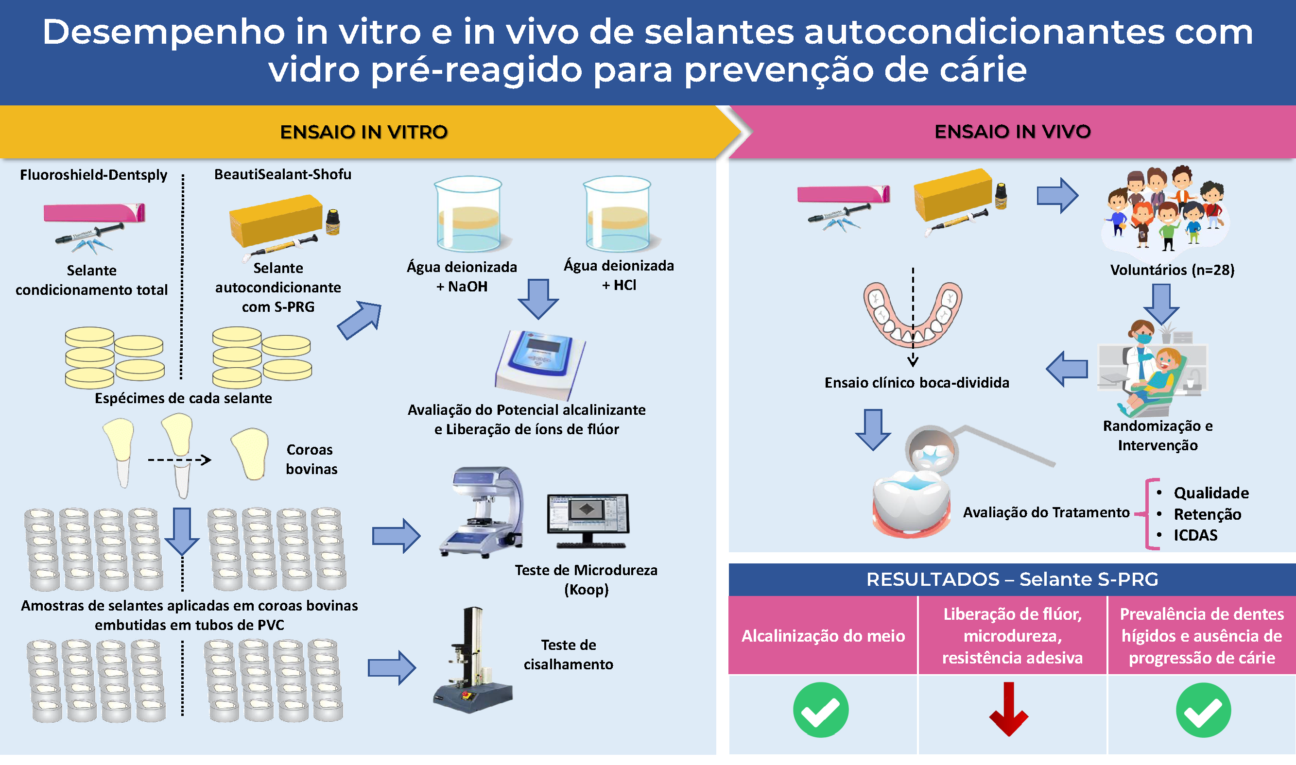 Estudo da UFMA investiga a eficácia de material selante autocondicionante com vidro pré-reagido na prevenção de cárie dental