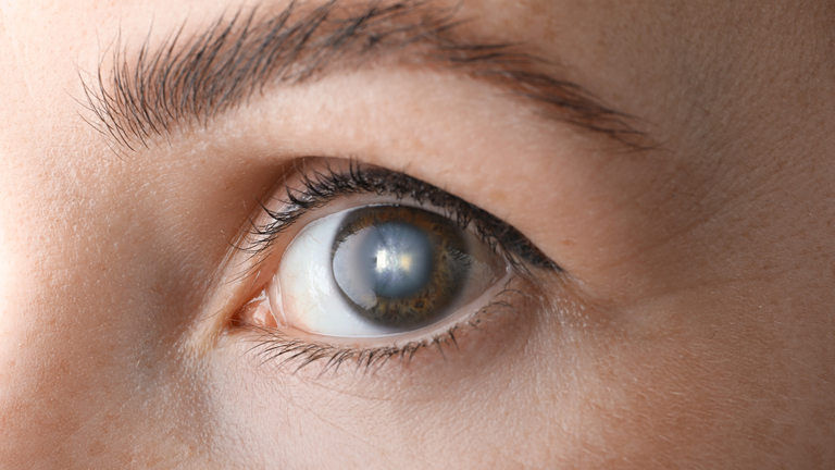 HU-UFMA atingiu no mês de outubro, a marca de 100 doações de córneas, só no ano de 2023