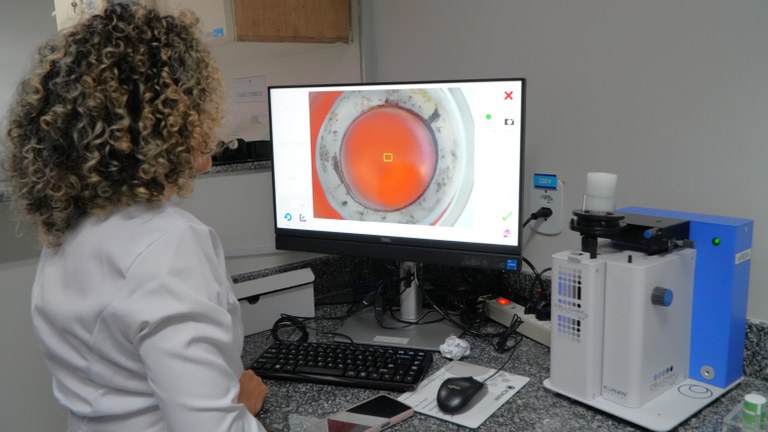 HU-UFMA reforça protagonismo na doação e transplante de córneas com marco de 4 mil procedimentos no Maranhão
