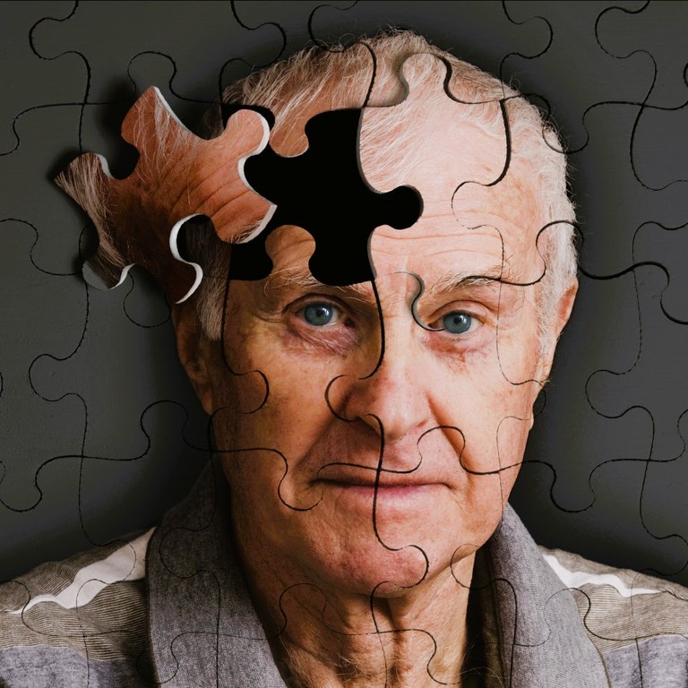 alzheimer.jpg