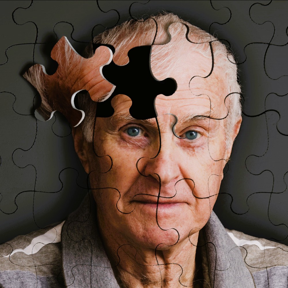 alzheimer.jpg