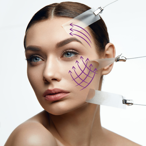 Fios de polidioxanona auxiliam na sustentação e cicatrização da pele