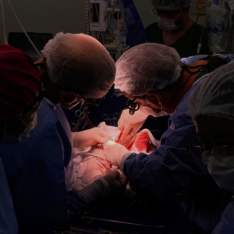 Hospital Universitário realizado o primeiro transplante de coração do Maranhão